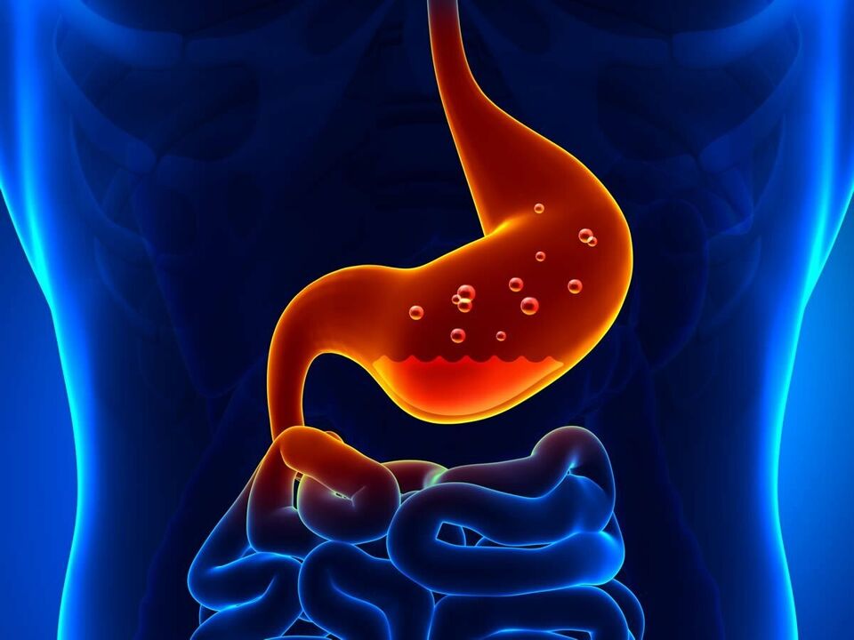 La gastrite est une maladie inflammatoire de l'estomac qui nécessite une nutrition